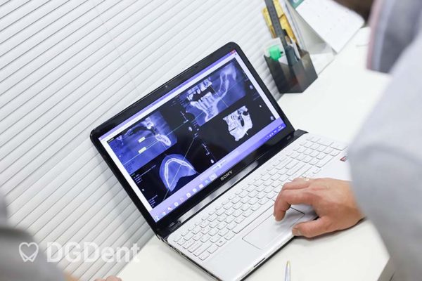 Современное оборудование и технологии для лечения зубов DGDent